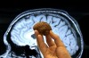 Cerveau imprimé en 3D à partir d'un IRM