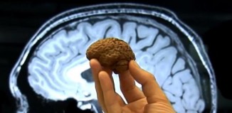 Cerveau imprimé en 3D à partir d'un IRM